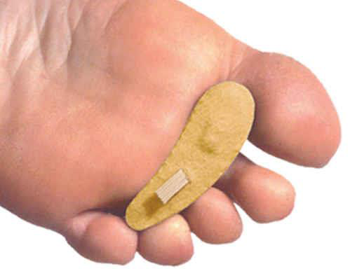 PediFix Felt Hammer Toe Cushion – Relief for Bent & Crooked Toes    PEDIFIX